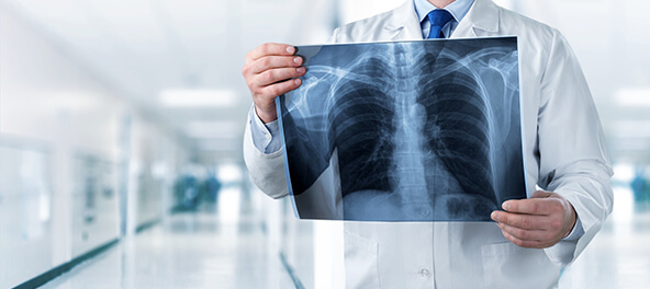 Doctor holding x-ray of chest