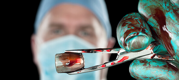 A surgeon holds a bloody bullet with a pair of clampling forcepts.