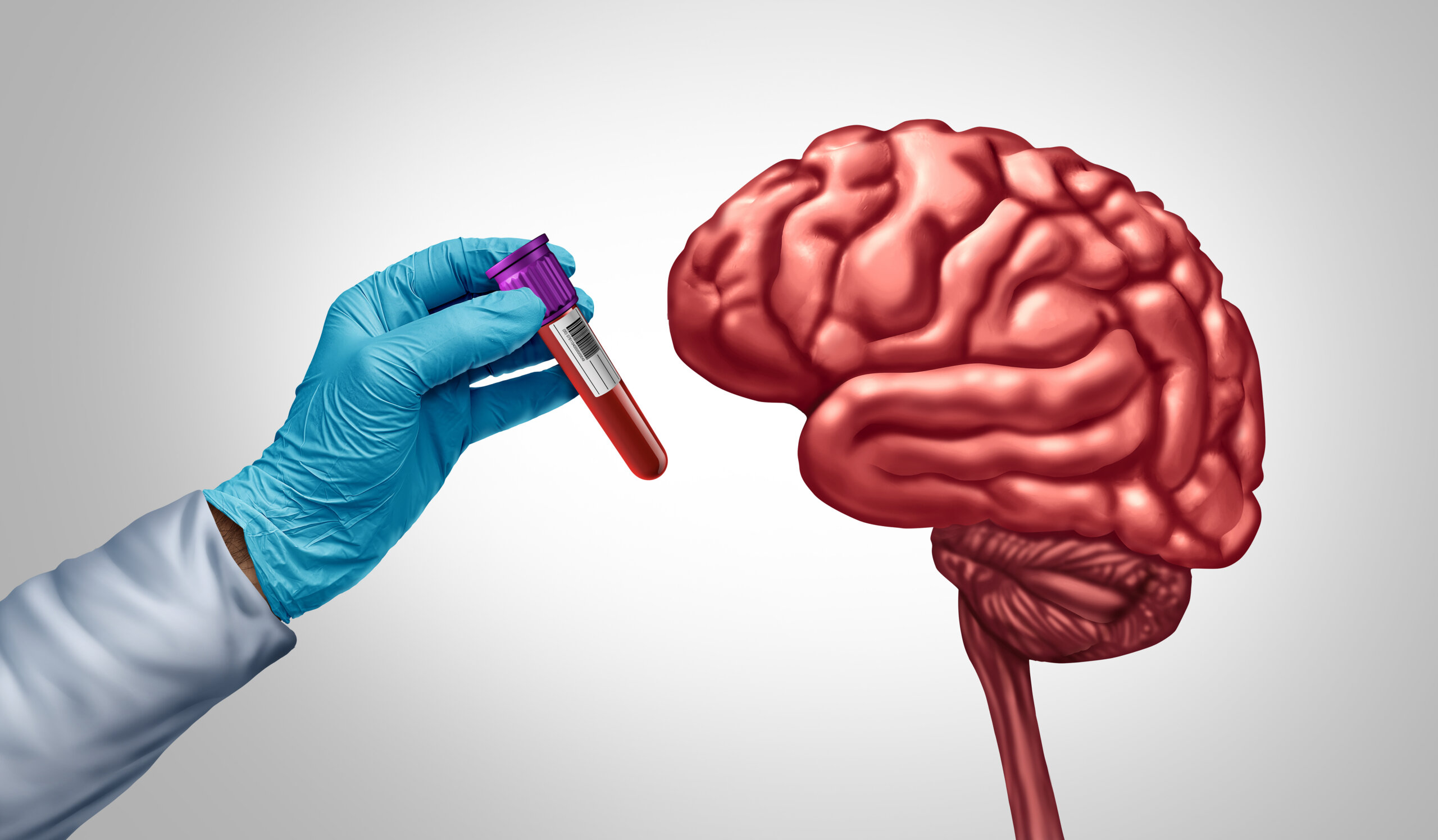 What a New Blood Test Means for Early Alzheimer’s Detection image